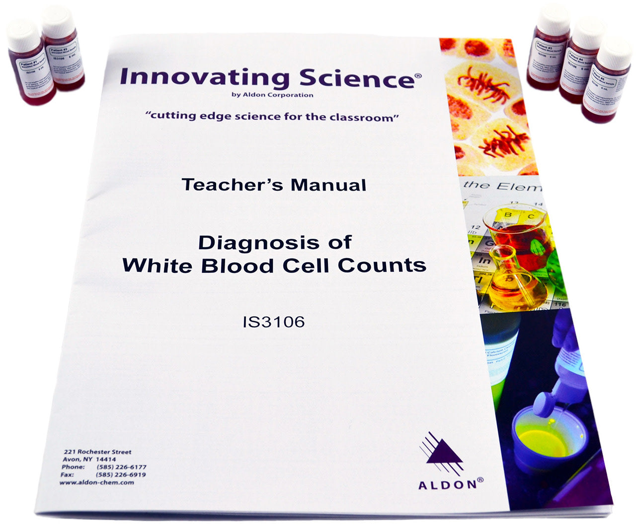 Diagnosis of White Blood Cell Counts Medical Diagnostics Lab Kit