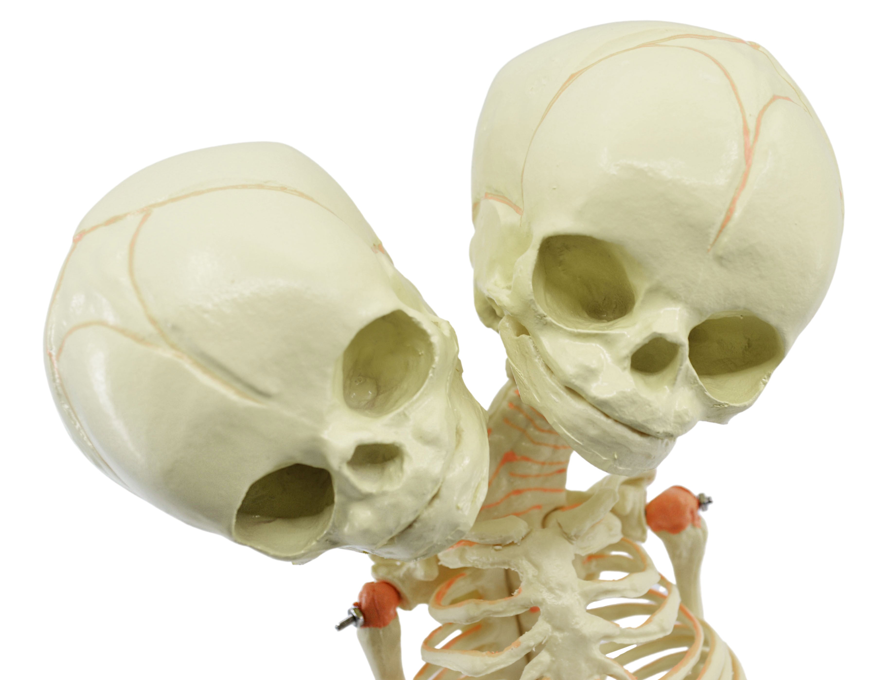 Infant Fetal Skeleton Model with Twin Conjoined Skulls, Mini Rod-Mounted