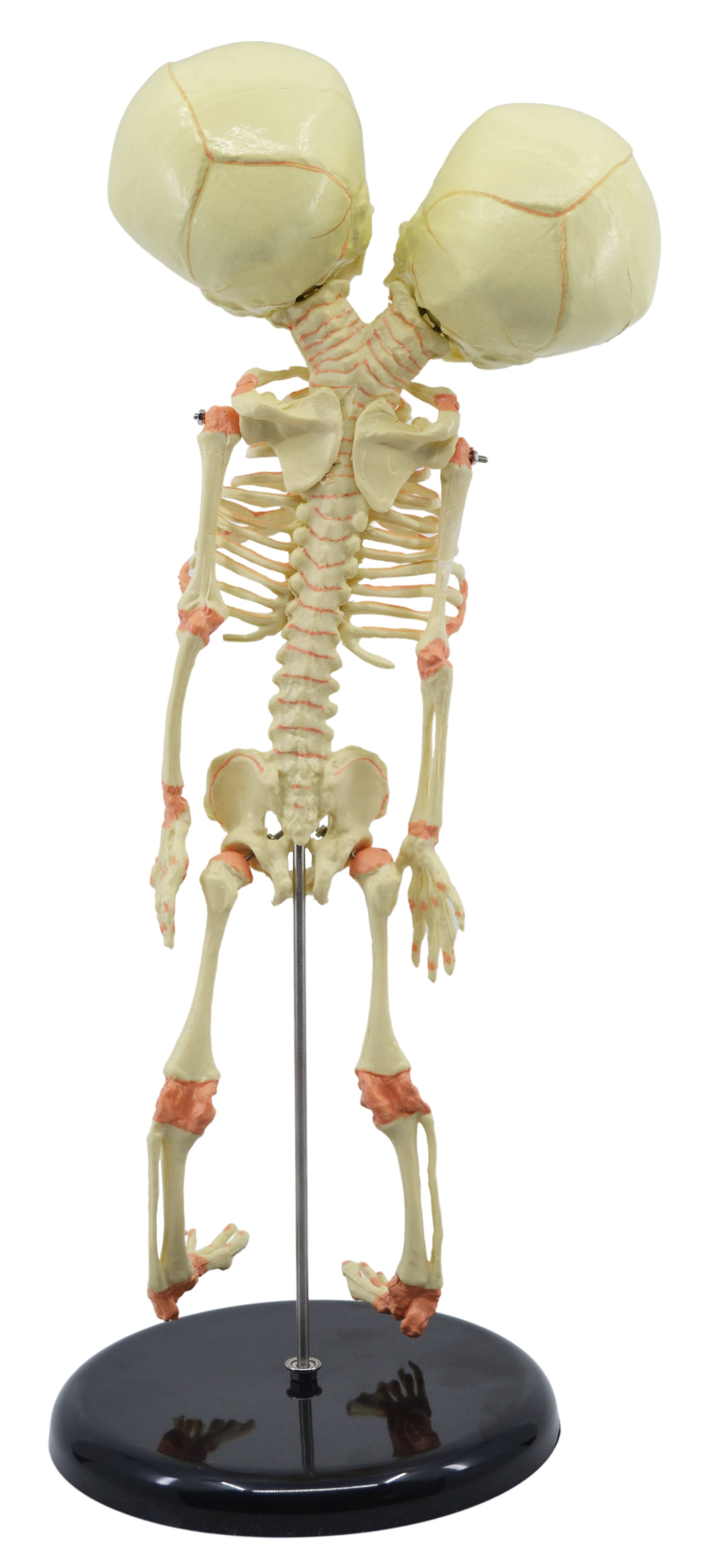 Infant Fetal Skeleton Model with Twin Conjoined Skulls, Mini Rod-Mounted