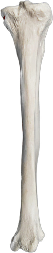 Right Tibia Bone Model