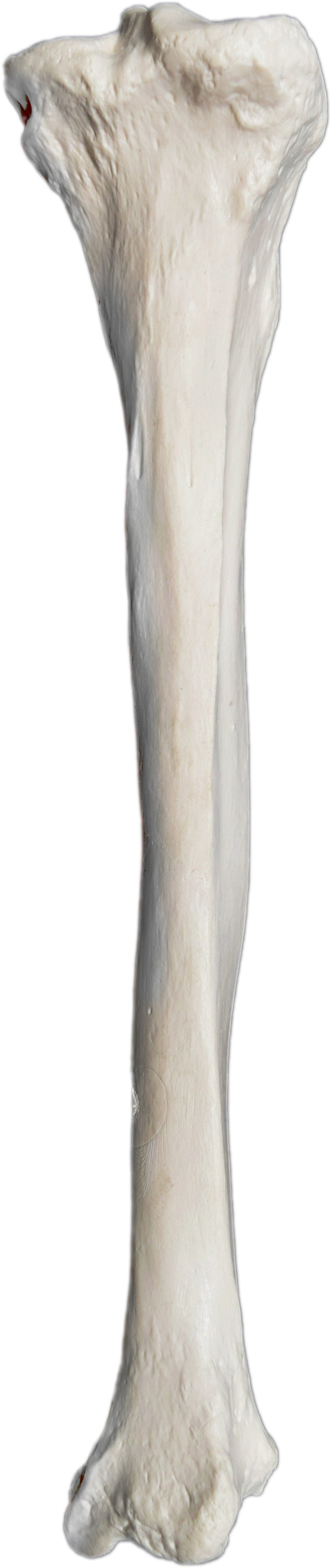 Right Tibia Bone Model
