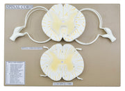 Spinal Cord Model with Nerve Branches, 17", 10X Enlarged