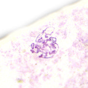 Drosophila Salivary Gland Chromosomes Prepared Microscope Slide