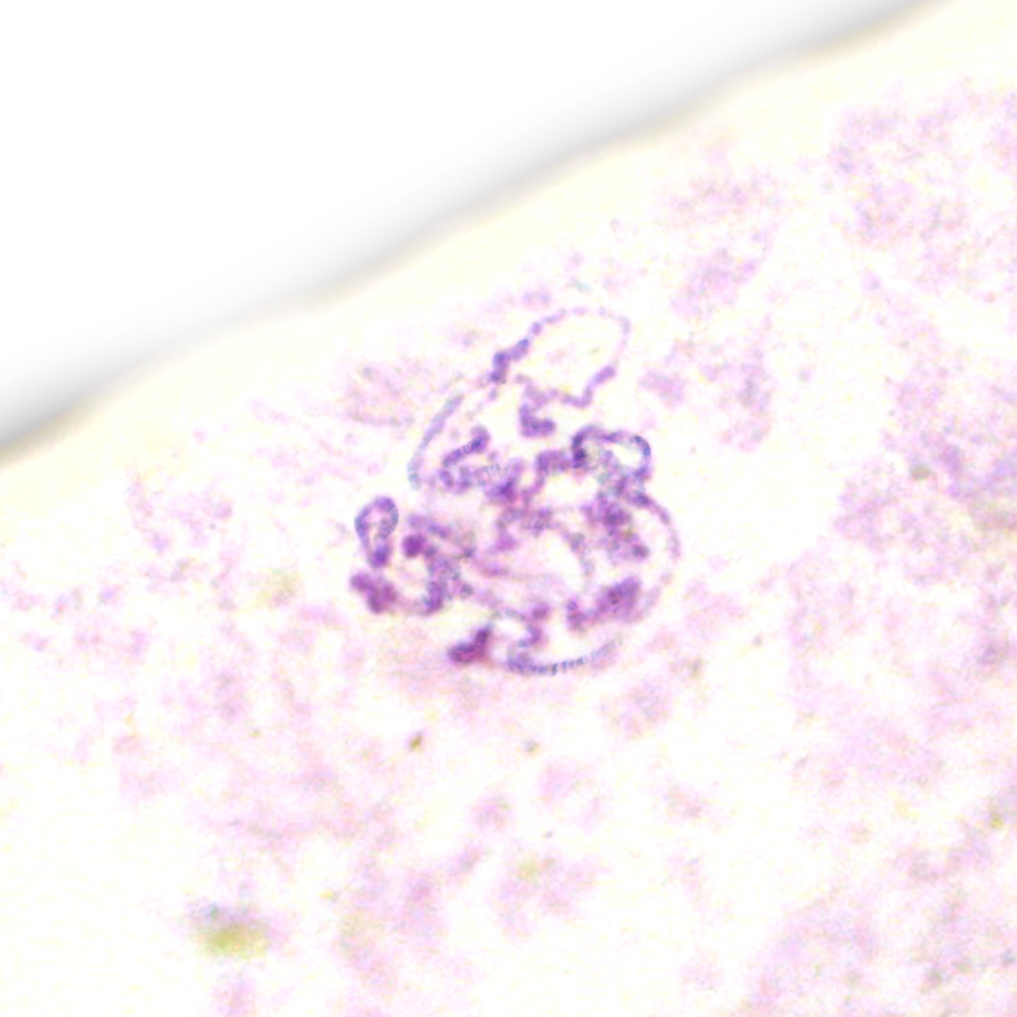 Drosophila Salivary Gland Chromosomes Prepared Microscope Slide