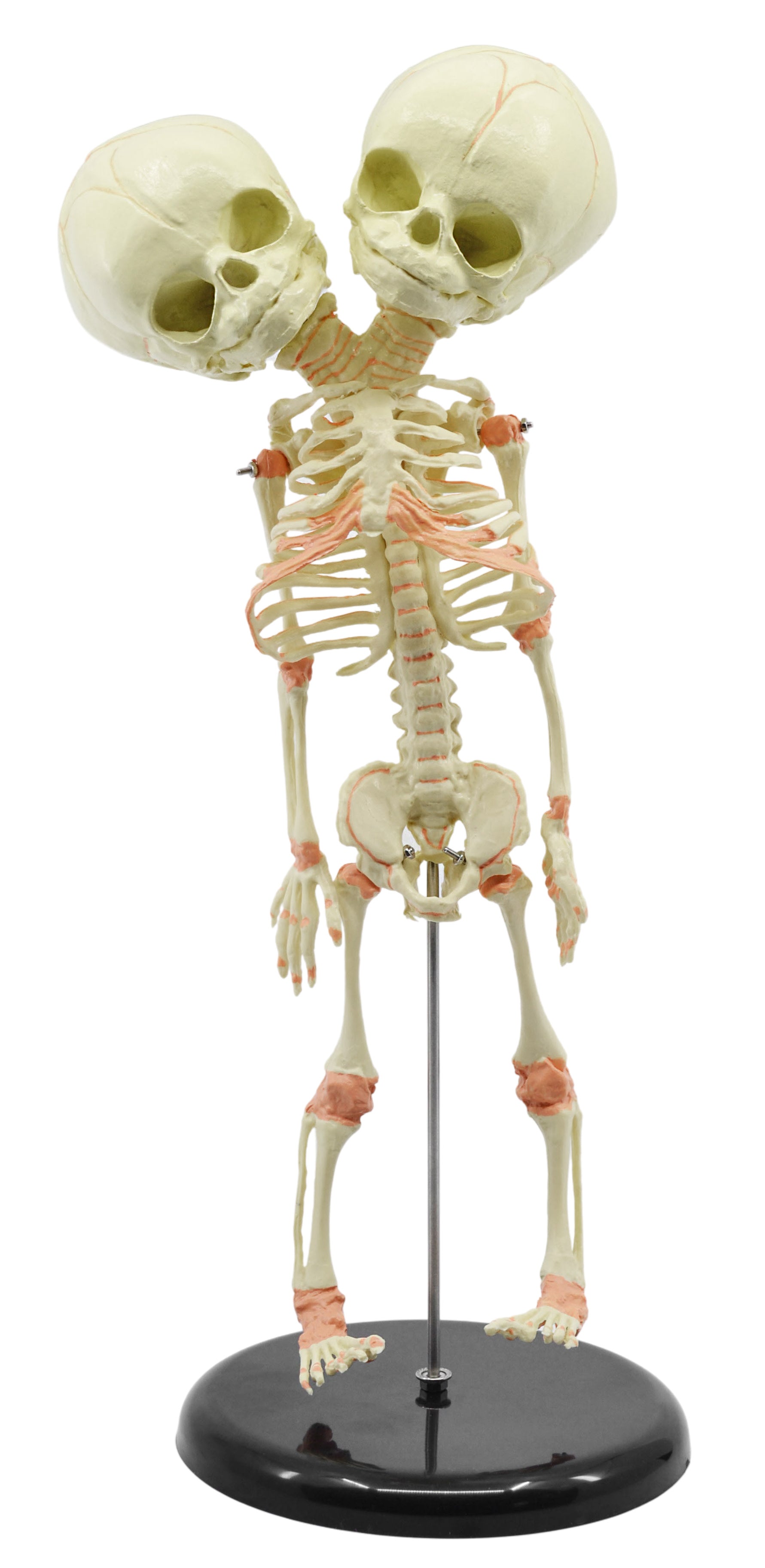 Infant Fetal Skeleton Model with Twin Conjoined Skulls, Mini Rod-Mounted