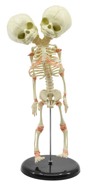 Infant Fetal Skeleton Model with Twin Conjoined Skulls, Mini Rod-Mounted
