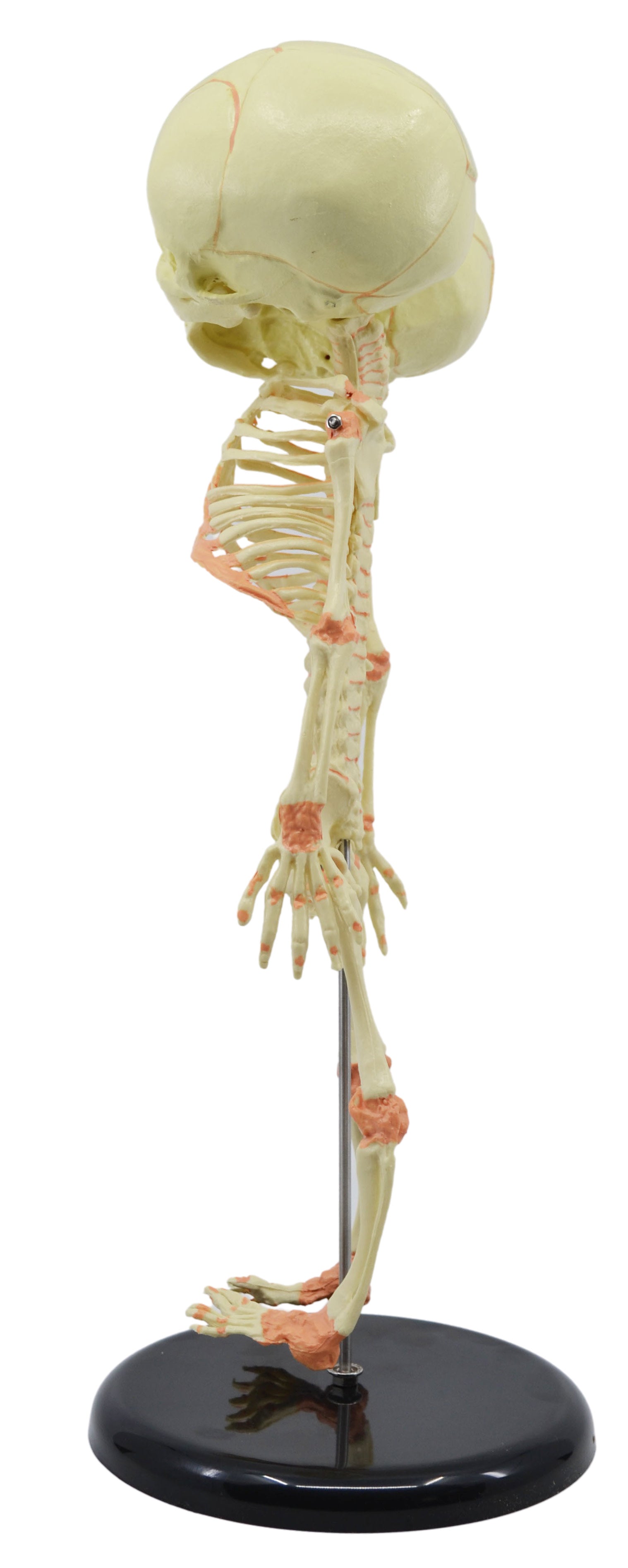 Infant Fetal Skeleton Model with Twin Conjoined Skulls, Mini Rod-Mounted