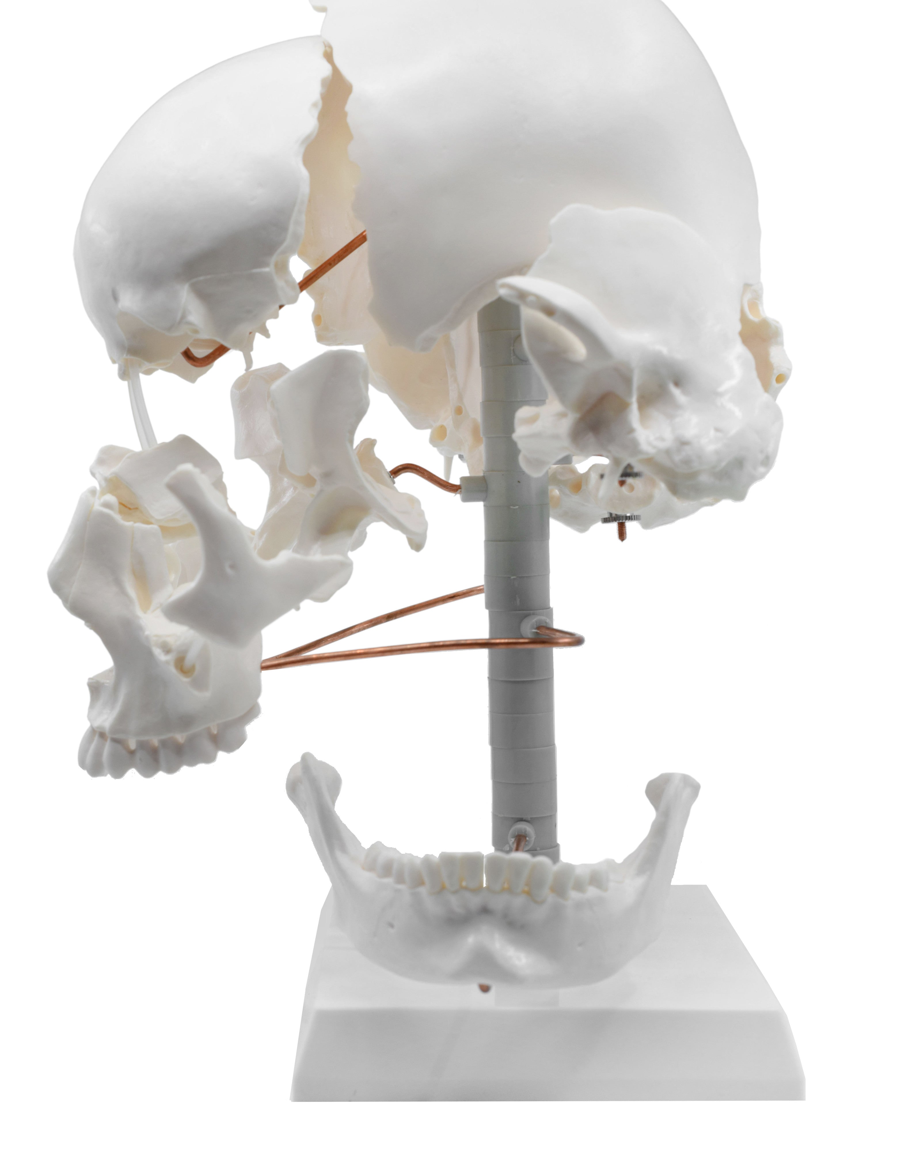 Beauchene Exploded Skull Model, Life Size, 13-Part on Articulated Stand