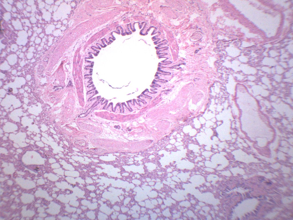 Human Lung Section Prepared Microscope Slide