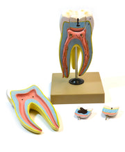 Upper Triple Root Molar Model with Interchangeable Cavities, 6-Part