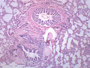 Human Lung Section Prepared Microscope Slide