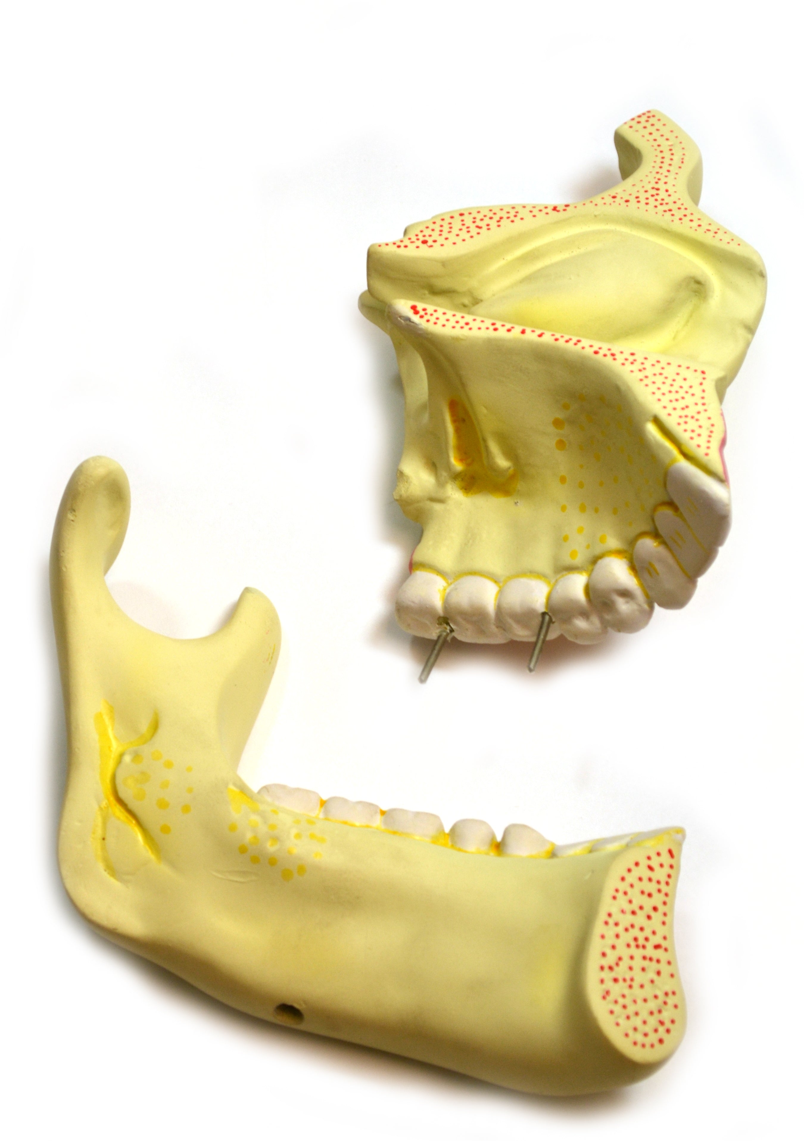 Upper and Lower Jaw Model, 4X Enlarged, on Stand