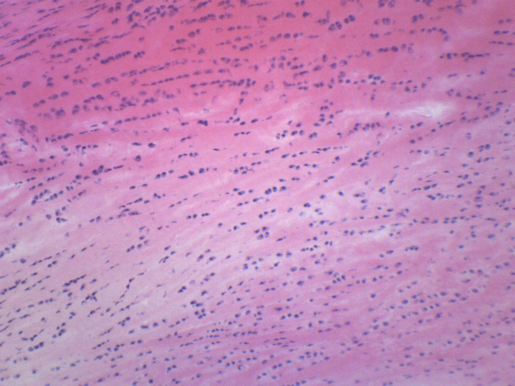 White Fibrocartilage (Mammal) Prepared Microscope Slide