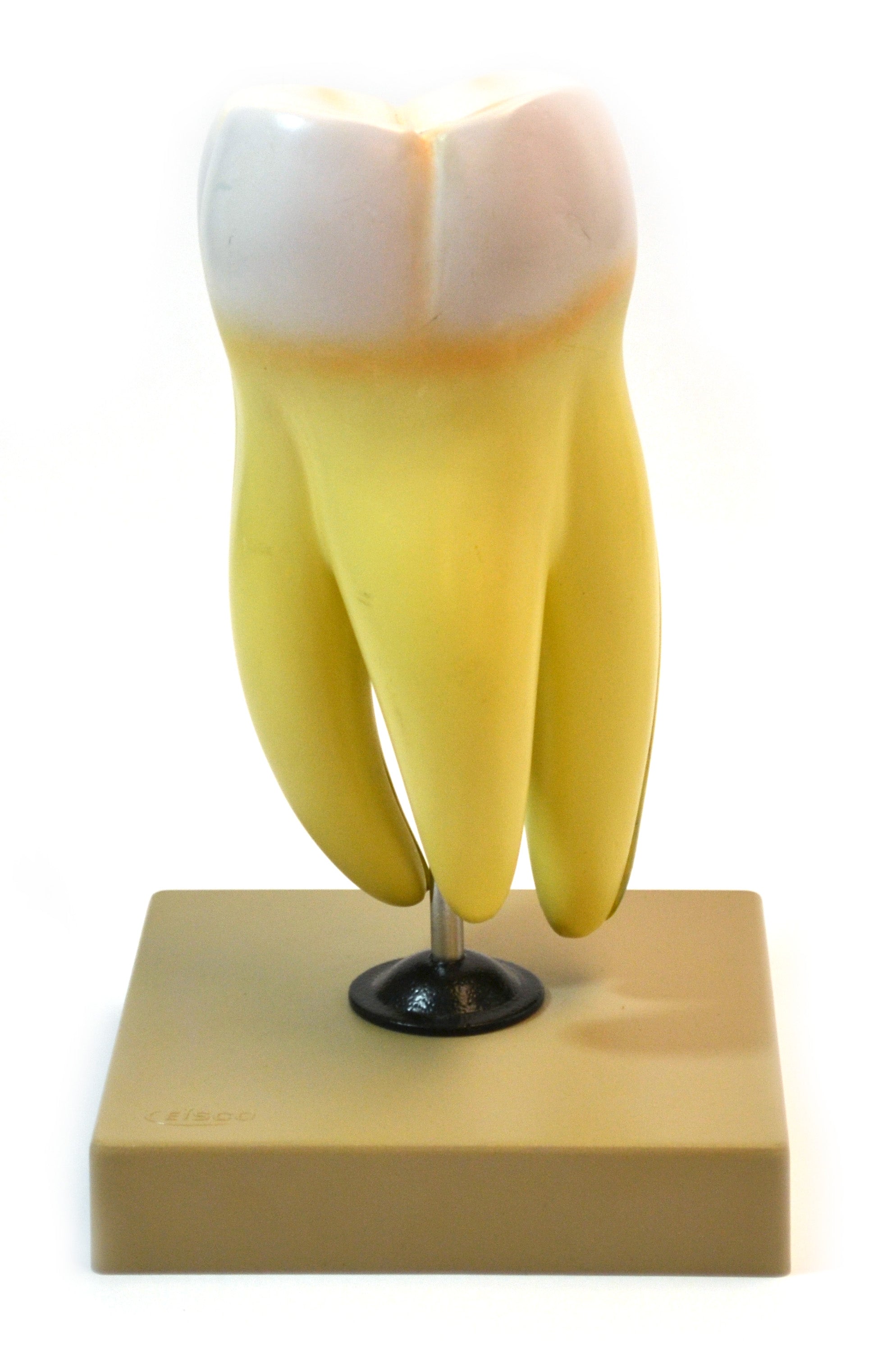Upper Triple Root Molar Model with Interchangeable Cavities, 6-Part
