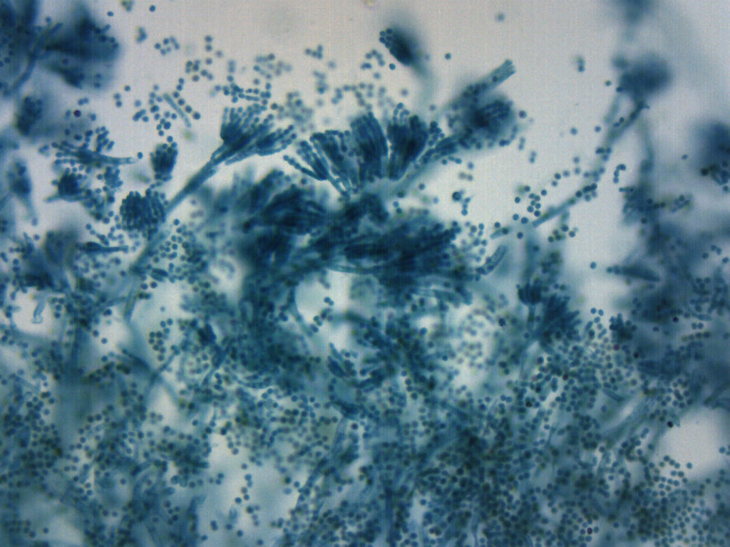 Penicillium Prepared Microscope Slide