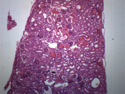Frog Kidney Section H&E Stain Prepared Microscope Slide