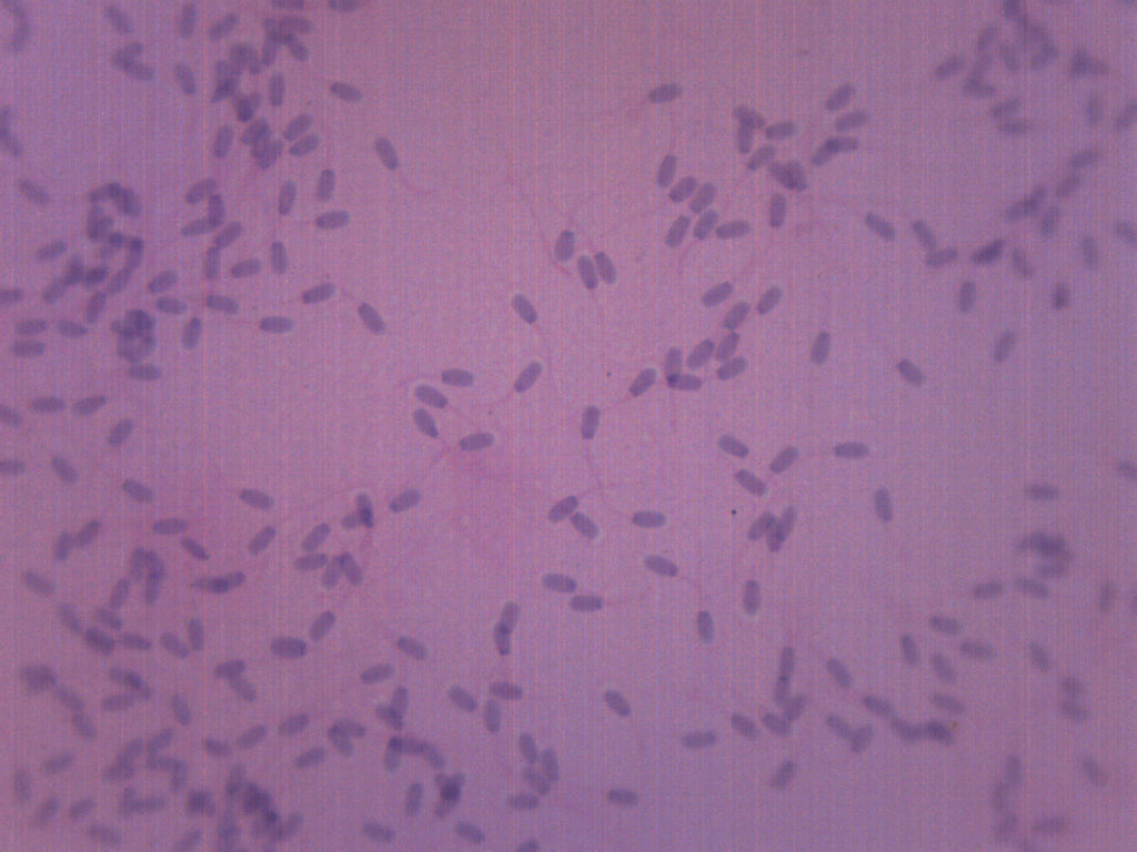 Sperm Smear (Mammal) Prepared Microscope Slide