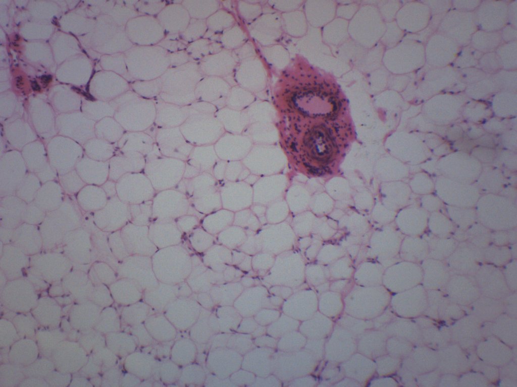 Adipose Tissue (Mammal) Prepared Microscope Slide