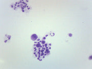 Female Human Chromosome Smear Prepared Microscope Slide