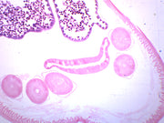 Ascaris Lumbricoides Prepared Microscope Slide