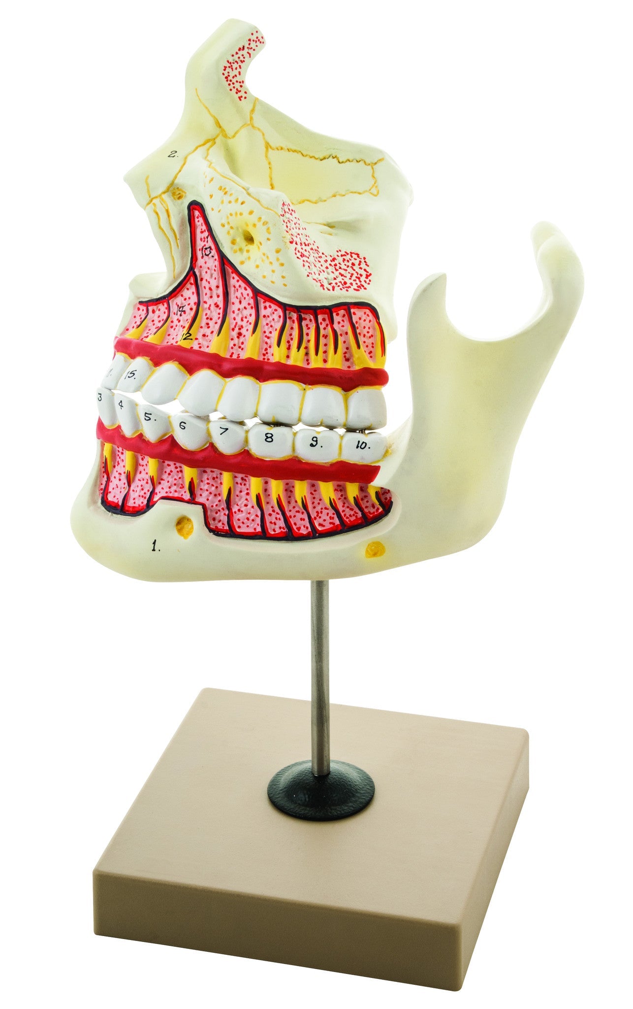Upper and Lower Jaw Model, 4X Enlarged, on Stand