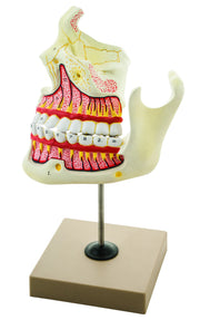 Upper and Lower Jaw Model, 4X Enlarged, on Stand