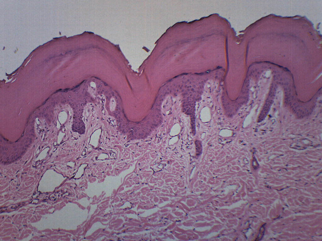 Human Skin Cross-Section Prepared Microscope Slide