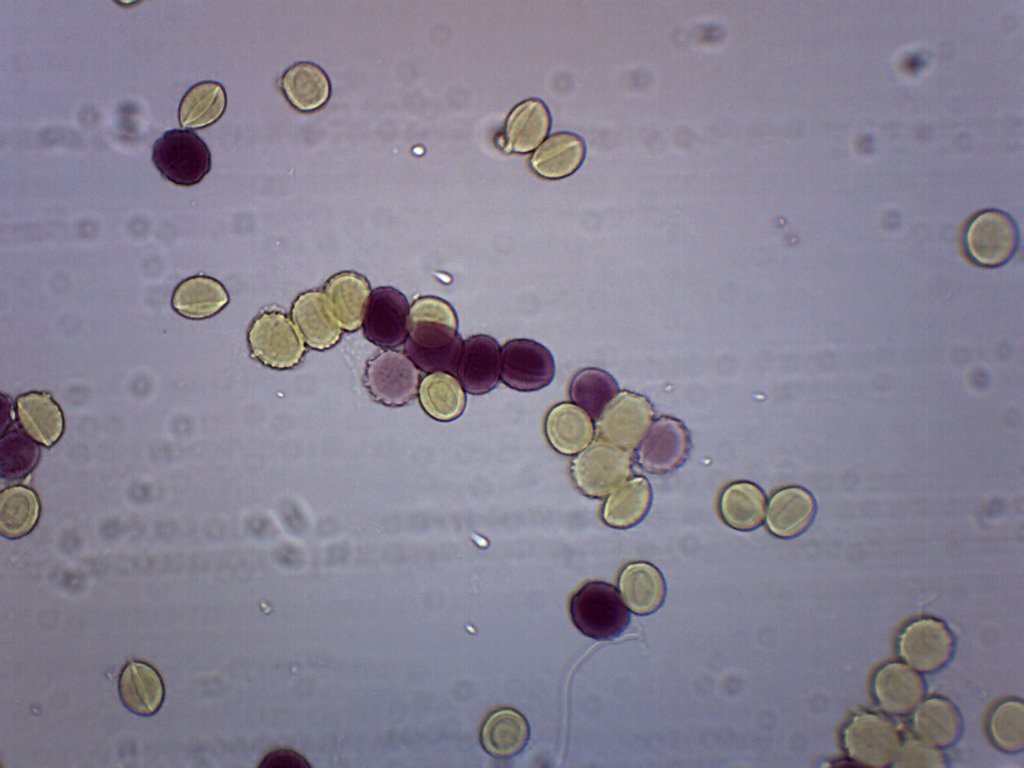Ascaris Lumbricoides Egg Wholemount Prepared Microscope Slide