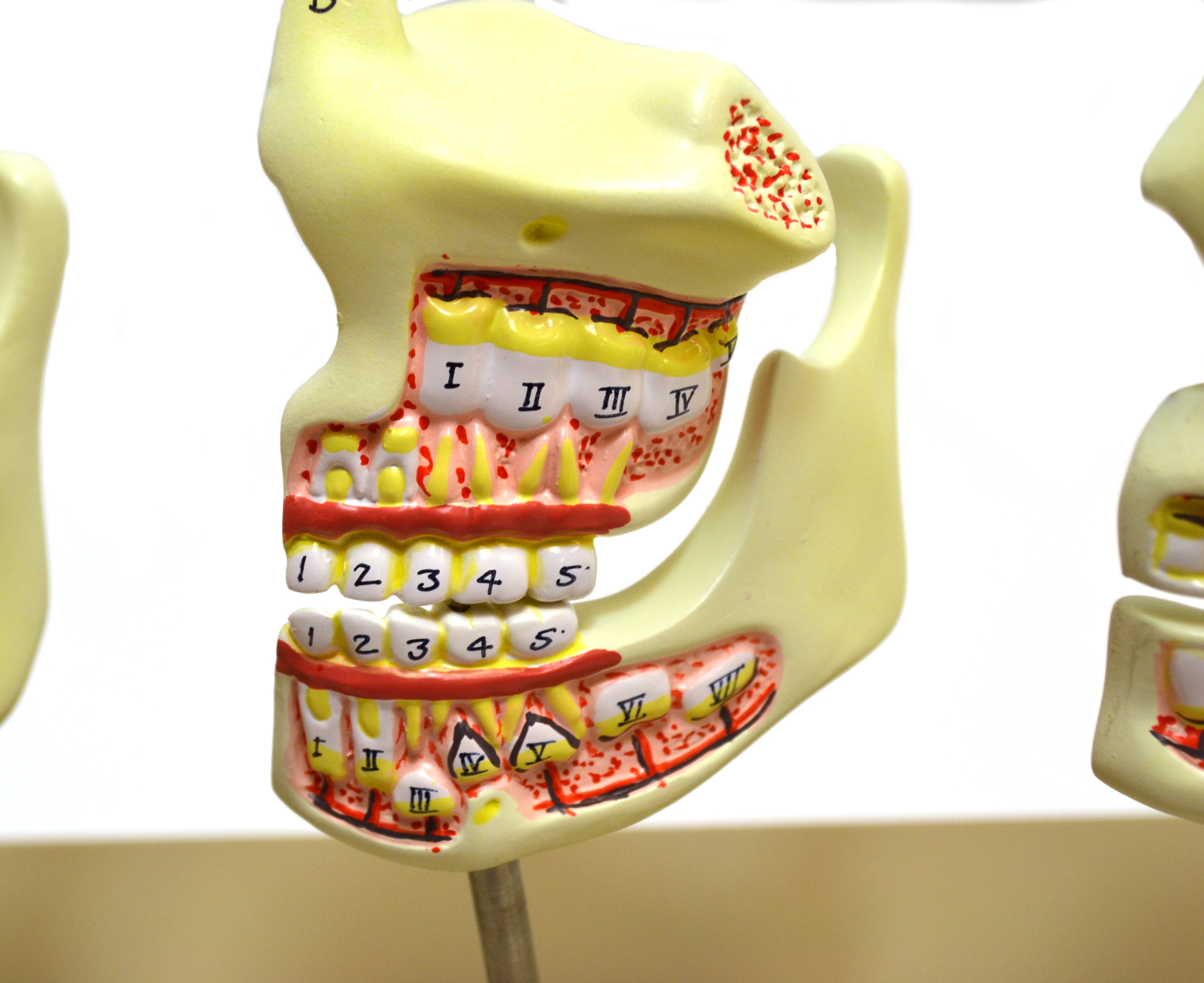 Human Dentition Model, 4 Stages, 8-Piece