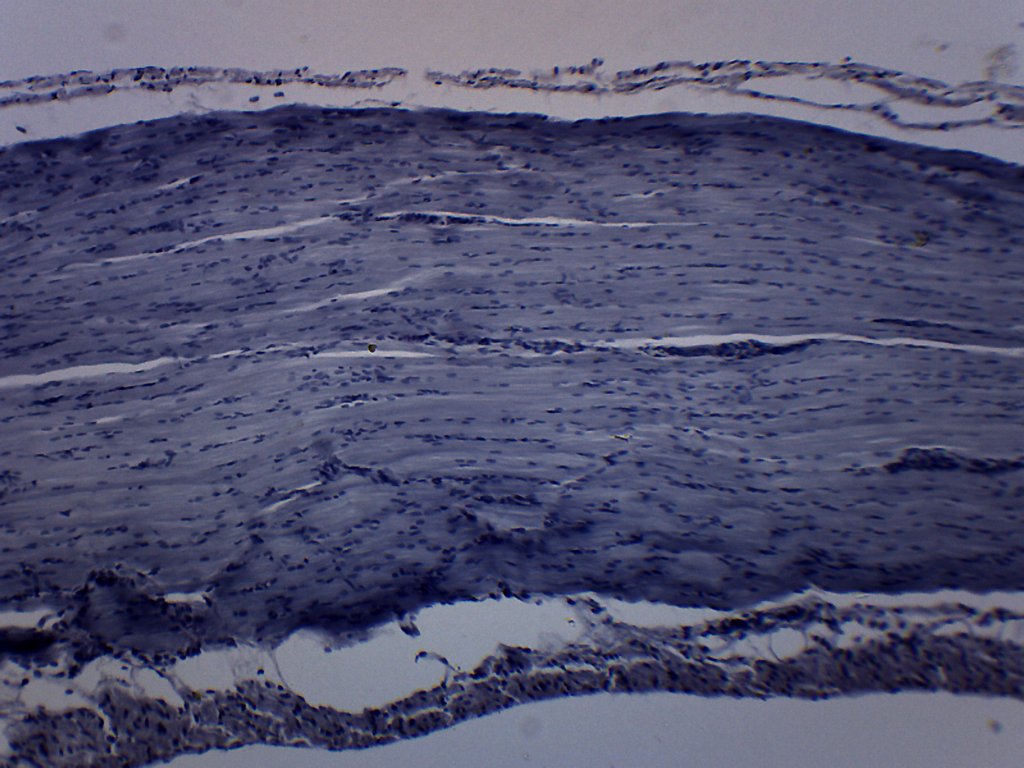 Frog Striated Skeletal Muscle Prepared Microscope Slide