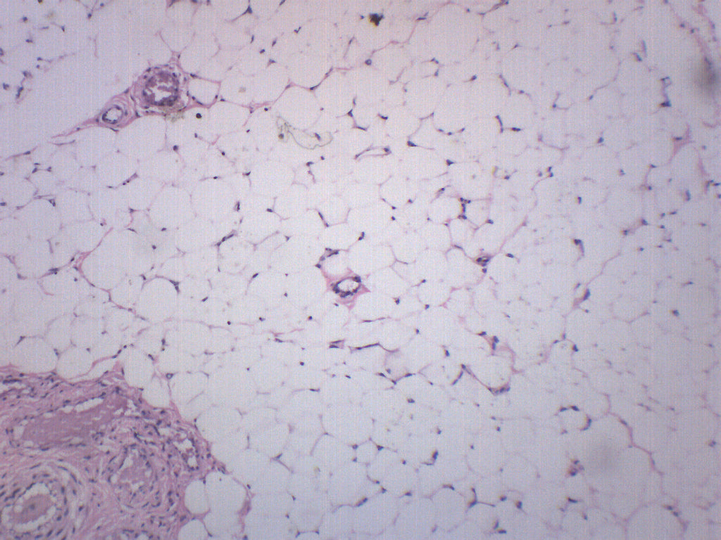 Adipose Tissue Section (Human) Prepared Microscope Slide