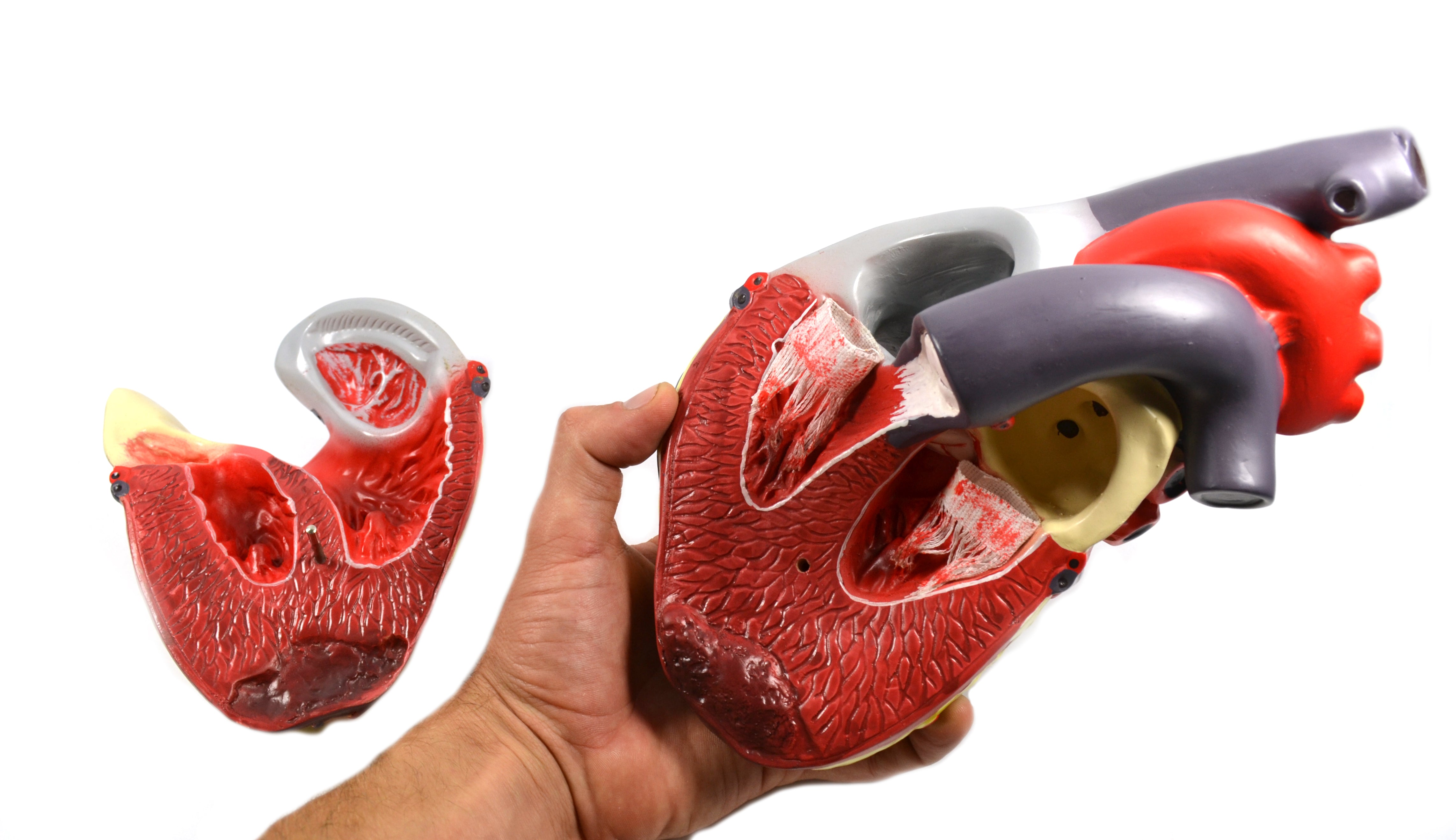 Human Heart Conditions Pathology Model with Artery Cross-Sections, 10"