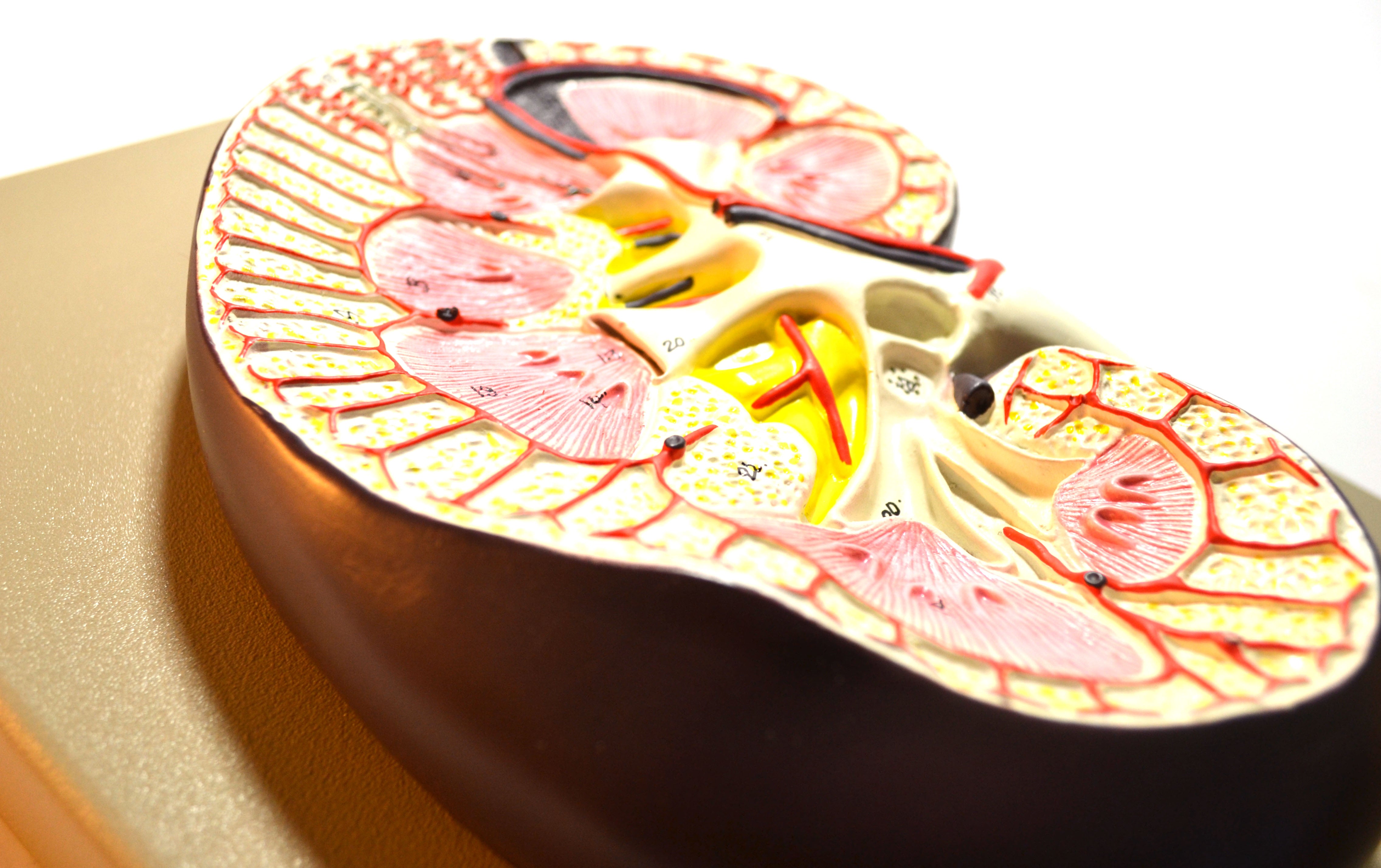 Human Kidney Cross-Section Model, 3X Life Size