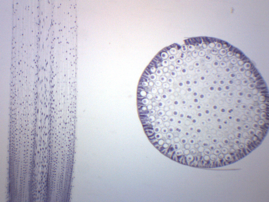 Ascaris and Onion Mitosis Prepared Microscope Slide