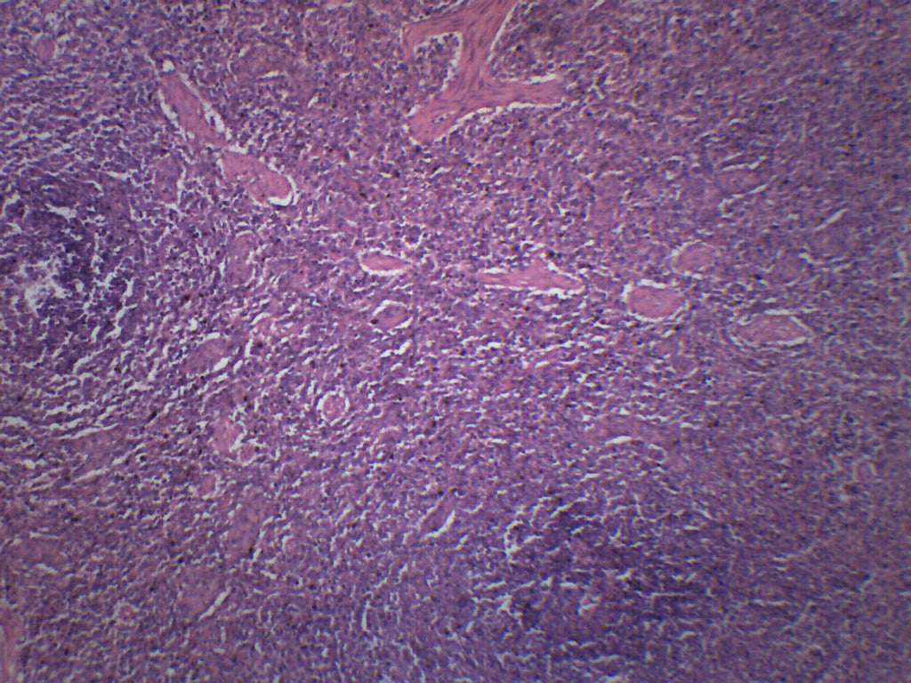 Human Spleen Section with HE Stain Prepared Microscope Slide