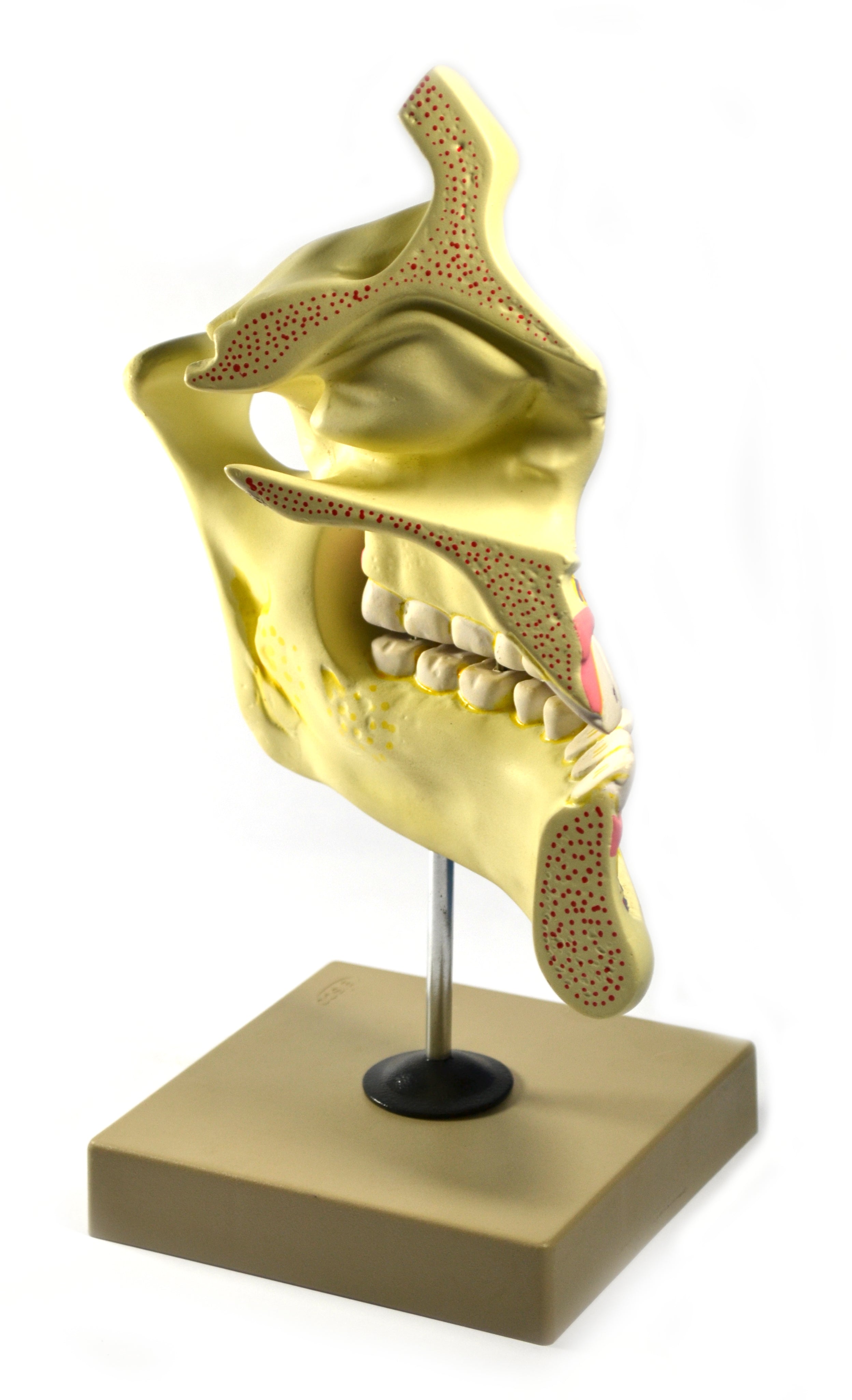 Upper and Lower Jaw Model, 4X Enlarged, on Stand
