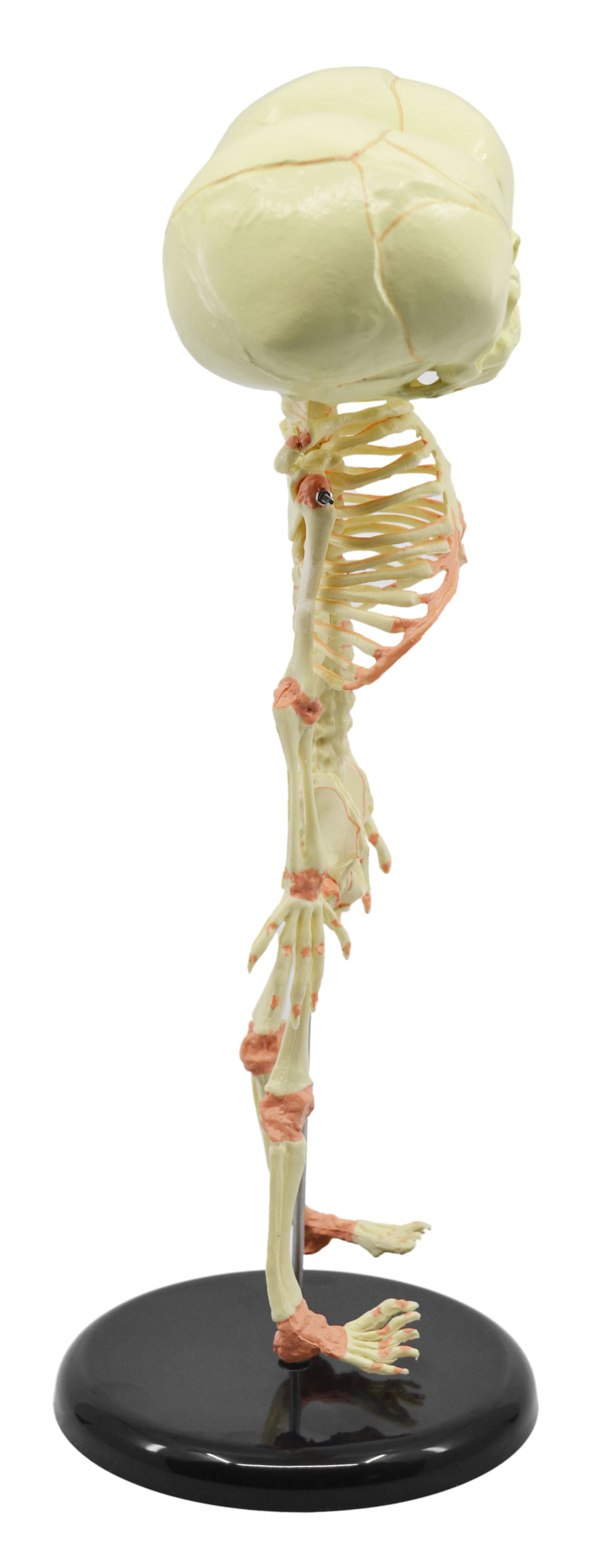 Infant Fetal Skeleton Model with Twin Conjoined Skulls, Mini Rod-Mounted