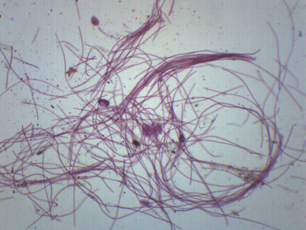 Oscillatoria Whole Mount Prepared Microscope Slide