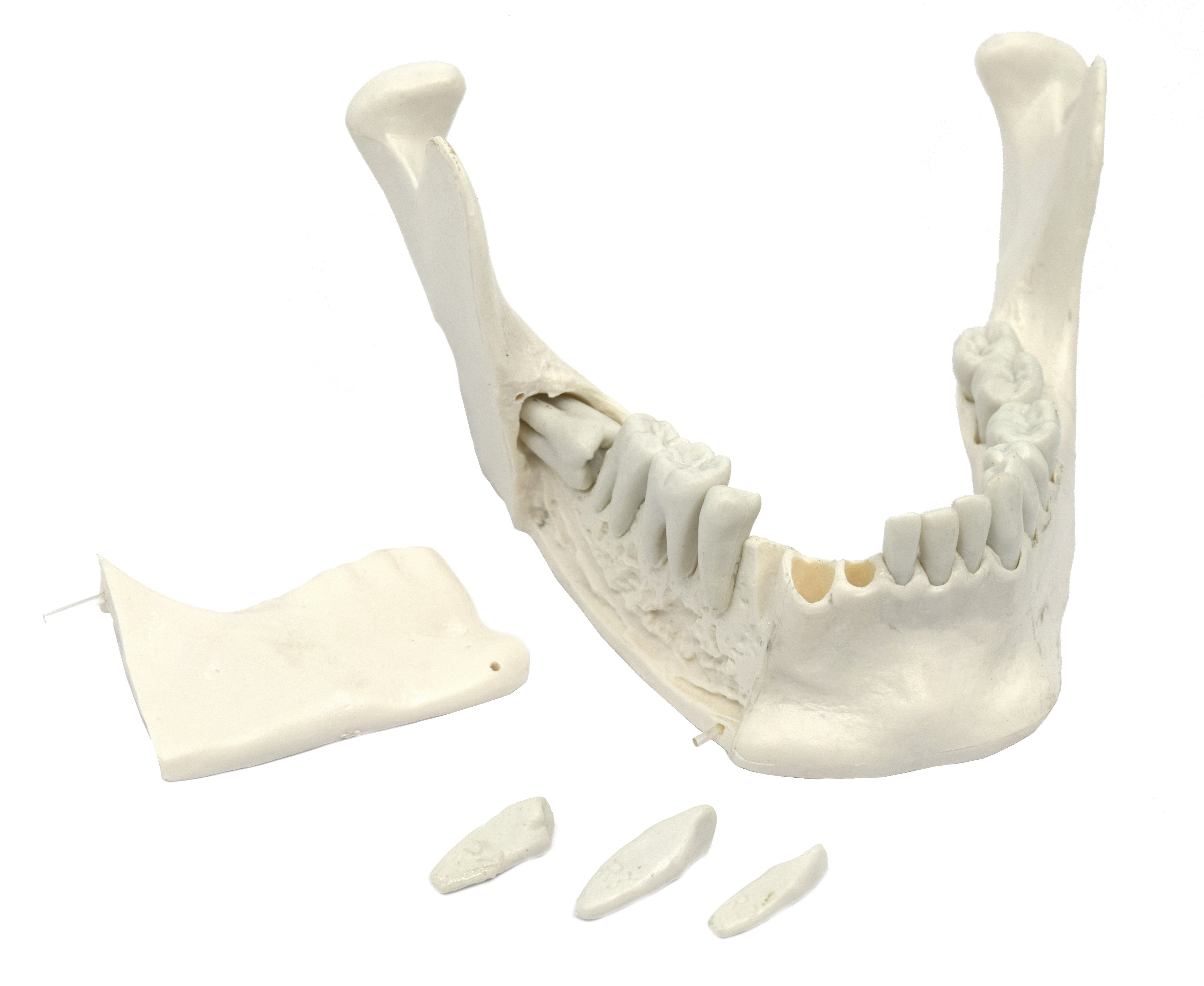 Lower Jaw Model with 16 Extractable Teeth