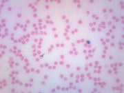 Human Blood Smear Prepared Microscope Slide