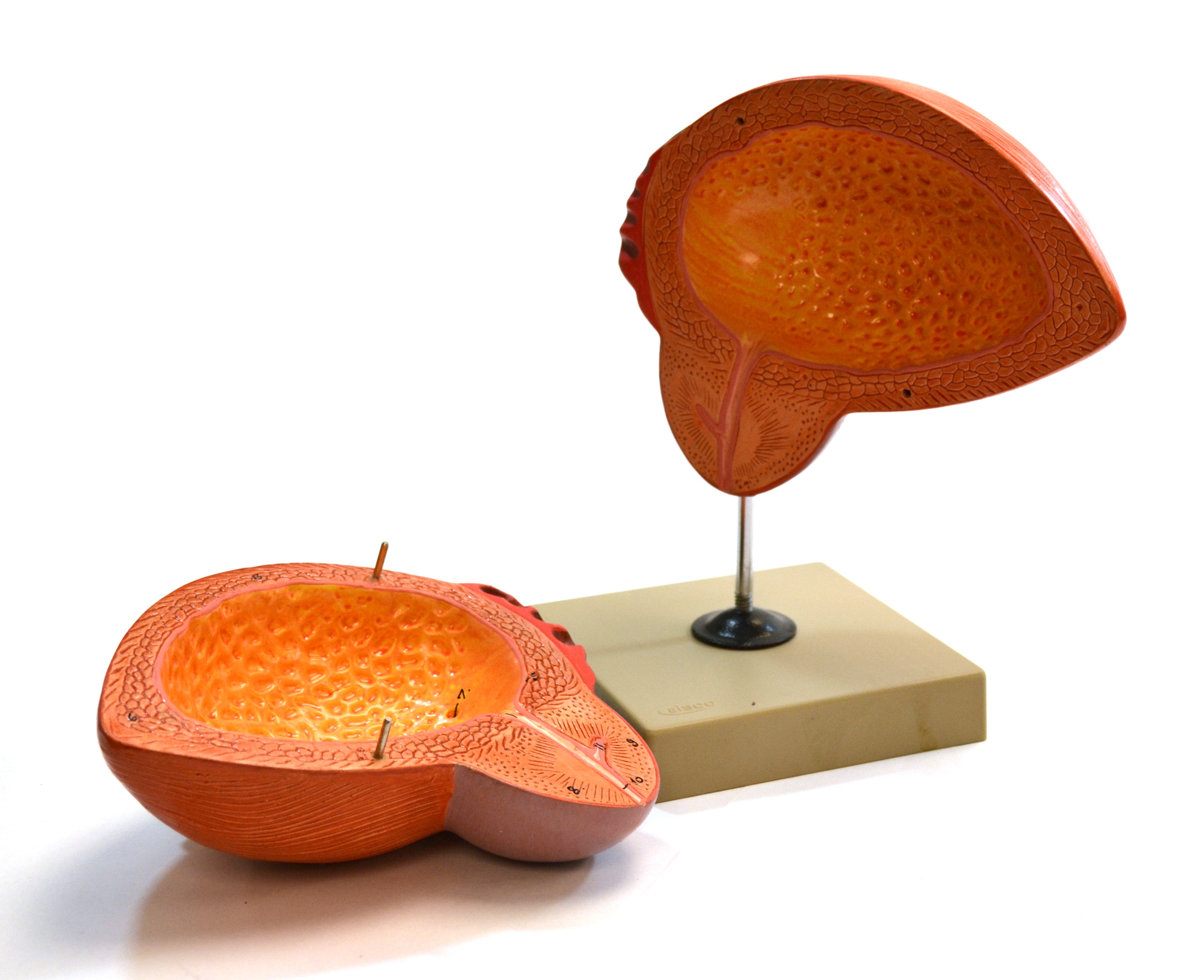Urinary Bladder with Prostate Anatomical Model, 3X Life Size, 2-Part, 8 x 8 x 6"