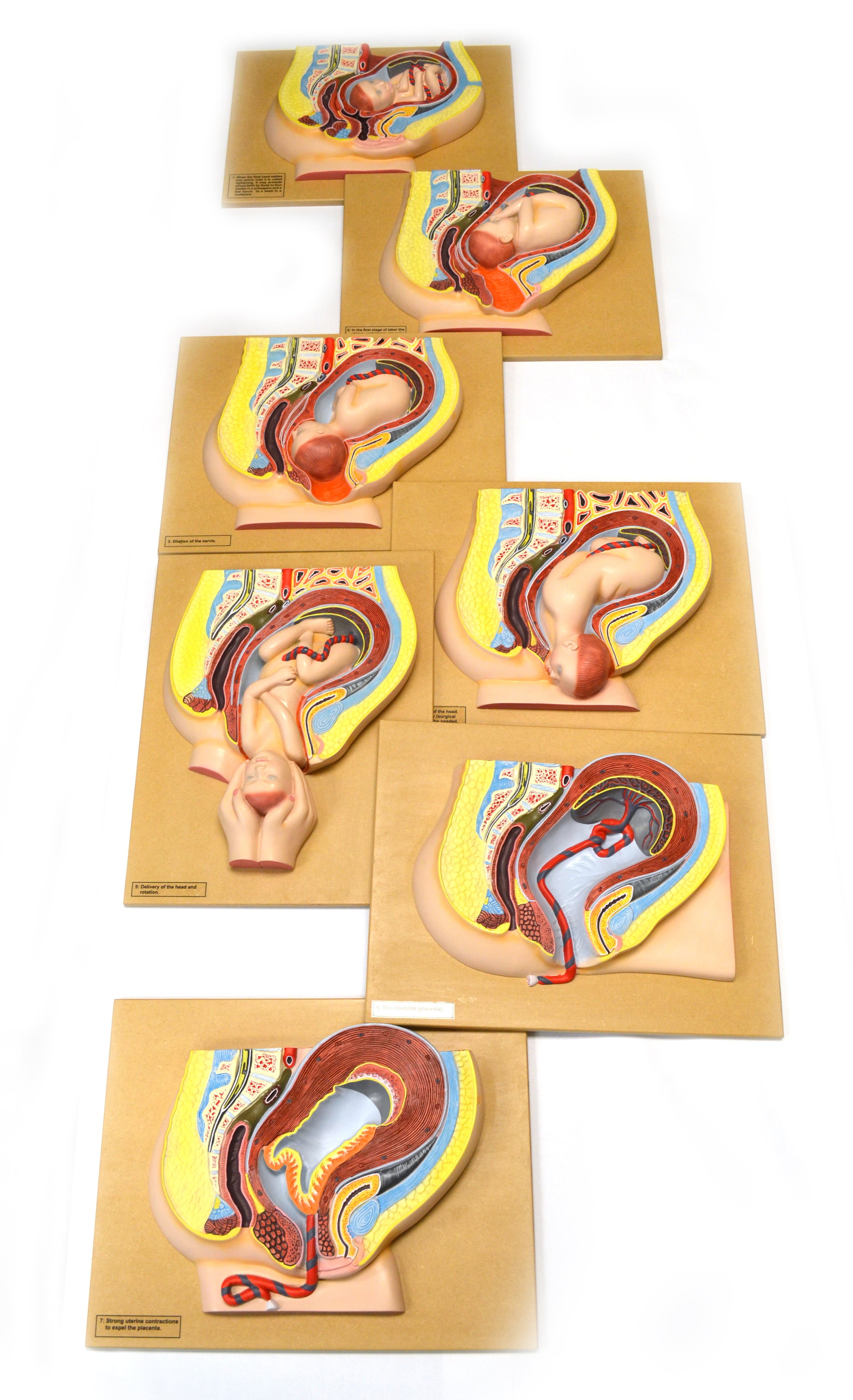 7-Piece Human Baby Delivery Stages Model Set, 18 x 14"
