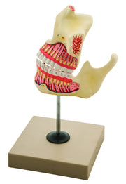 Upper and Lower Jaw Model, 3X Enlarged