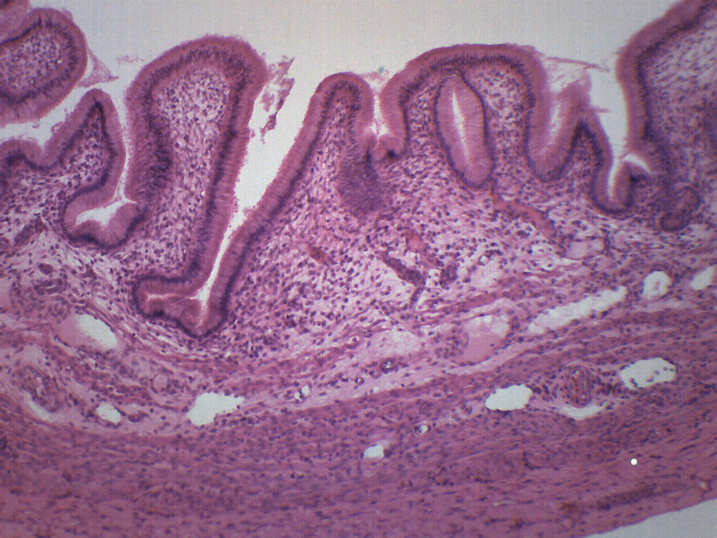 Gallbladder Cross-Section Prepared Microscope Slide