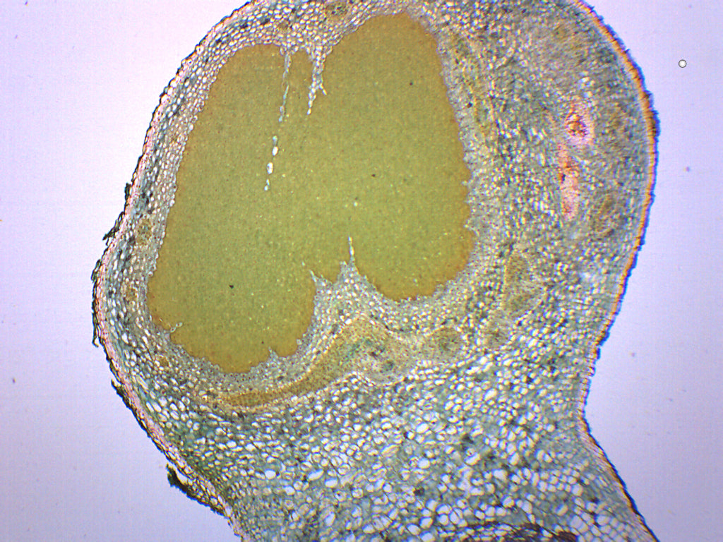 Legume Root Nodule Prepared Microscope Slide