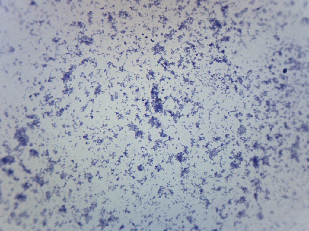 Mycobacterium Tuberculosis Wholemount Gram Positive Prepared Microscope Slide