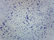 Mycobacterium Tuberculosis Wholemount Gram Positive Prepared Microscope Slide