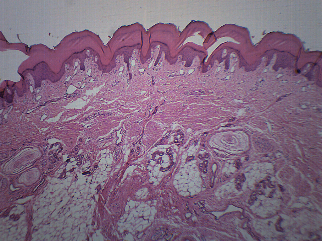Human Skin Cross-Section Prepared Microscope Slide