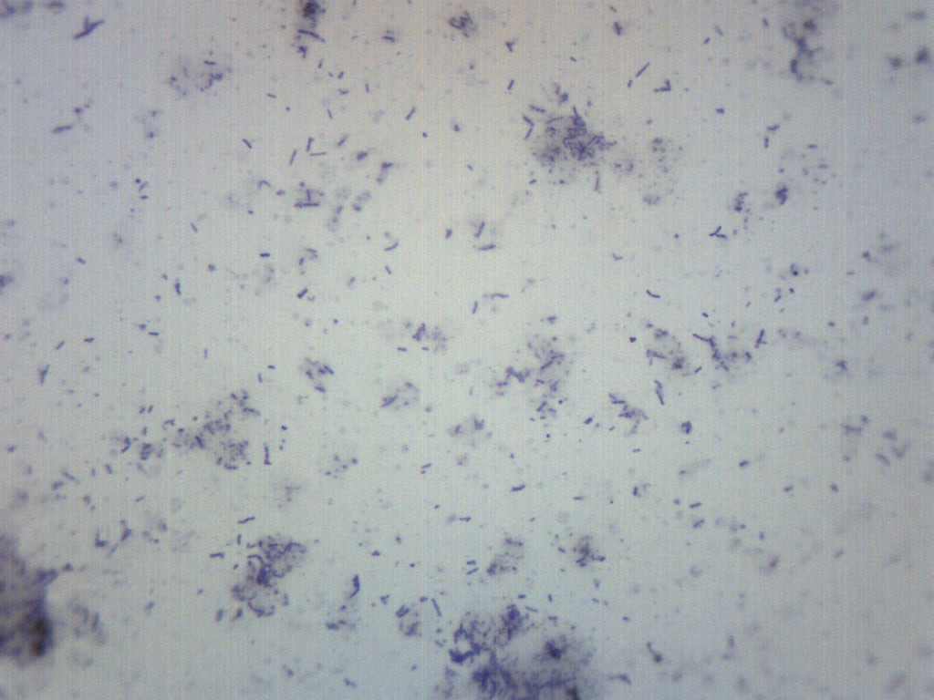 Bacteria from Mouth Prepared Microscope Slide, Alternate