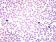 Human Blood Smear Prepared Microscope Slide, WR Stain